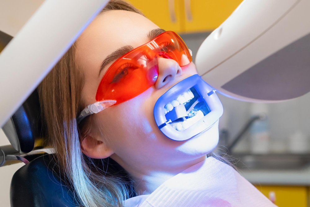 Teeth whitening